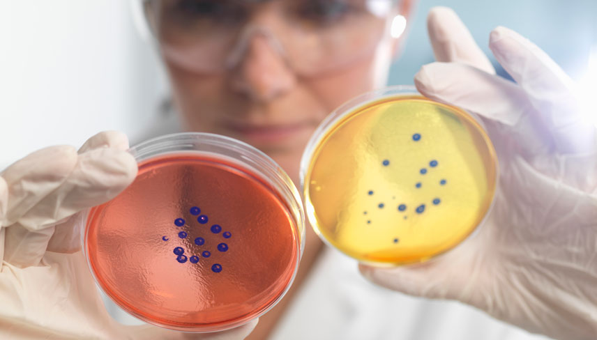 woman comparing two petri dishes